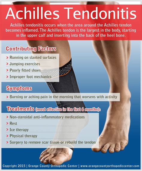 Achilles Tendonitis Orange County Orthopedic Center