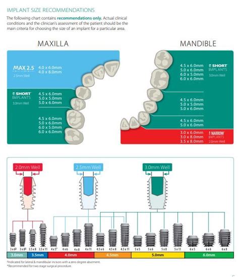 Dental Implant Size Chart