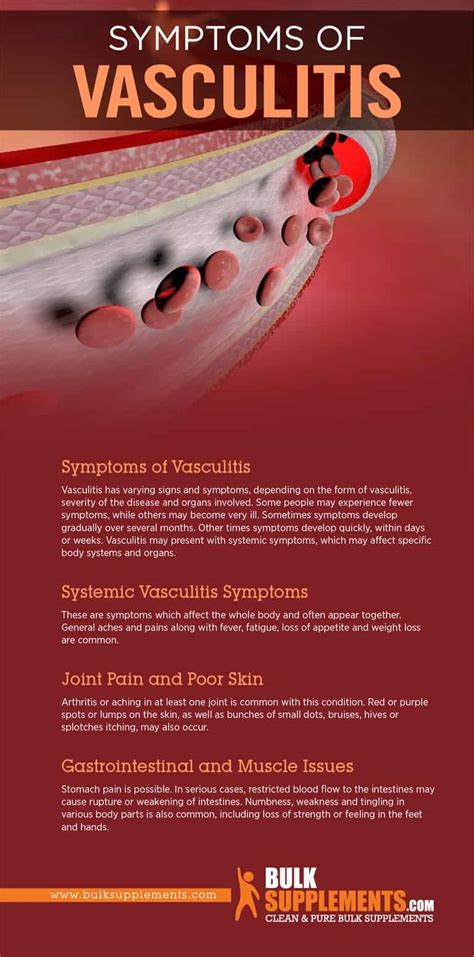 Vasculitis Symptoms Causes And Treatment