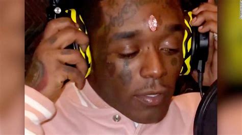 Lil Uzi Vert Says Fans Ripped 24 Million Diamond Out Of His Forehead