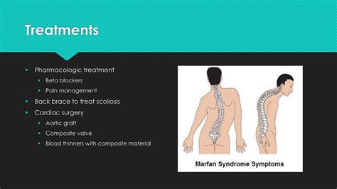 Marfan Syndrome Youtube