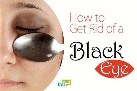 How To Get Rid Of A Black Eye Fast And Safely Fab How