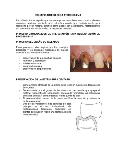 Principio Basico De La Protesis Fija Dentures Dentistry Branches