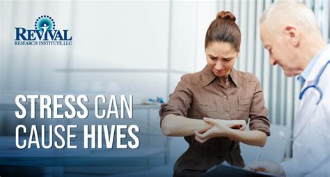 Stress Can Cause Hives