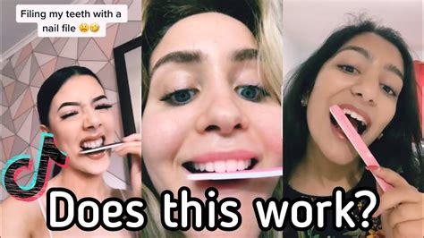 The Tiktok Filing Teeth Challenge That Dentists Are Warning About Youtube
