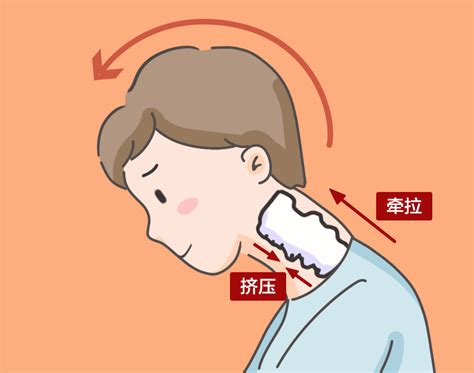颈源性头痛正确锻练 最新资讯 台湾传统软手法培训 叶慧阳