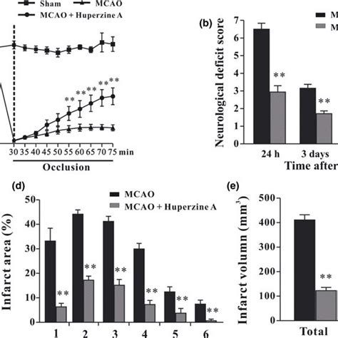 Protective Effects Of Huperzine A In Post Ischemic Brain A Huperzine