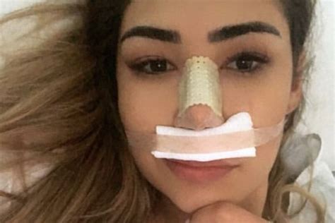 Ex Bbb Realiza Cirurgia Facial Saiba Mais