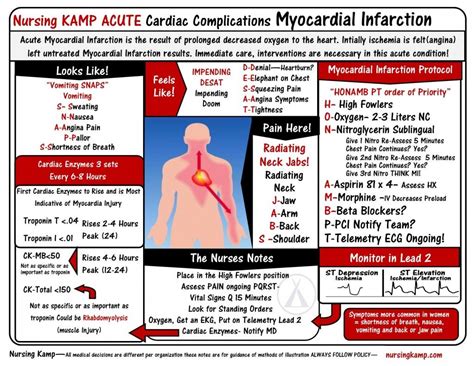 Nursing Cardiac Nursingkamp Myocardial Infarction Nursing KAMP StickEnote TWS Immediate