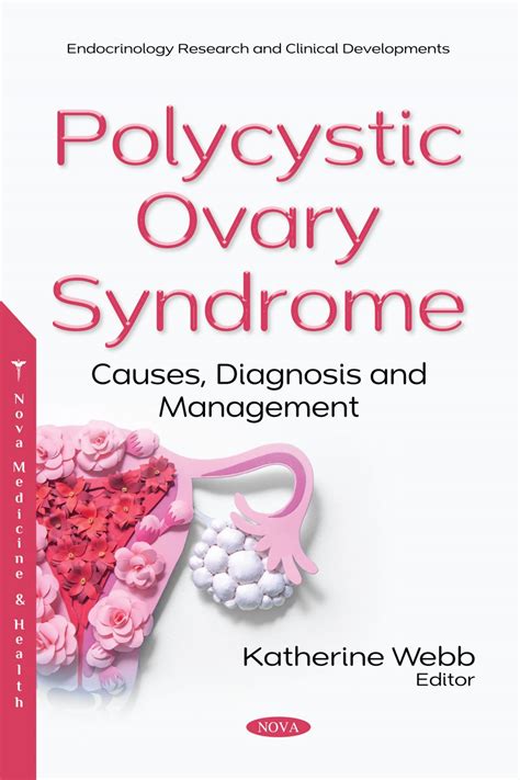 Polycystic Ovary Syndrome Causes Diagnosis And Management Nova