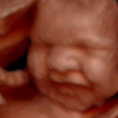 Video Image Gallery Mother Nurture Ultrasound