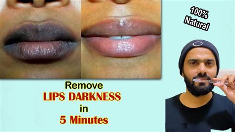 How To Lighten Dark Lips Naturally In 2 Steps Ll 100 Result Youtube