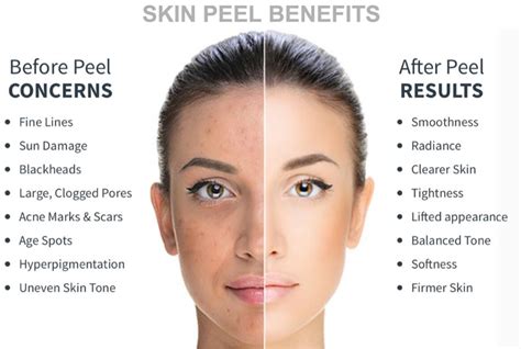 Chemical Peels How Do Chemical Peels Work Dermacare Clinic