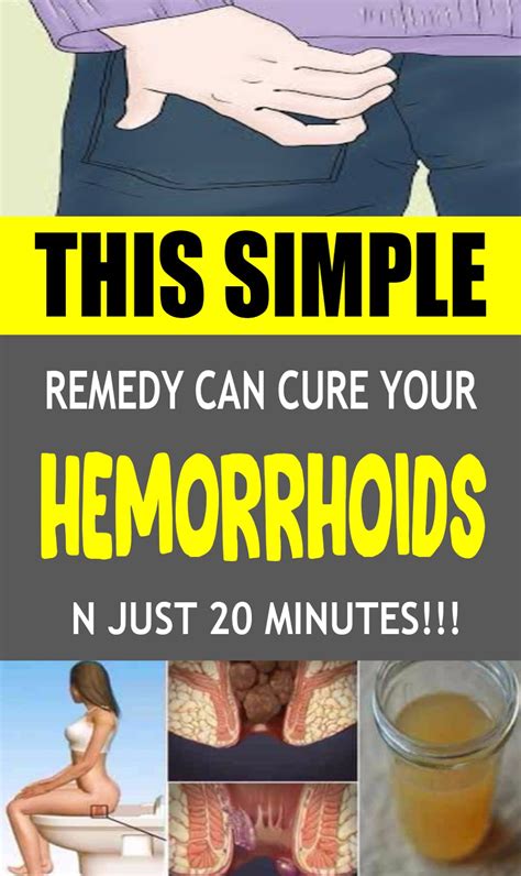 This Simple Remedy Can Cure Your Hemorrhoids In Just Minutes Health Ideas