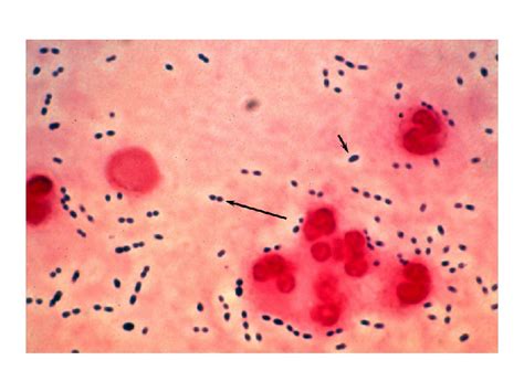 Streptococcus Pneumoniae Cocci In Pairs Gram Streptoc