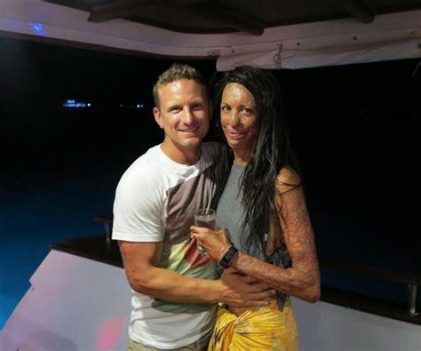 The Luckiest Girl In The World The Beautiful Way Turia Pitt And