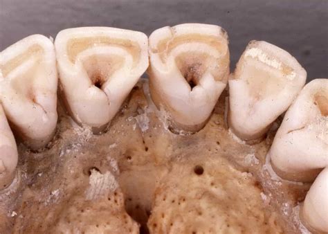 Breastfeeding Changed Tooth Shape In Pre Native American People