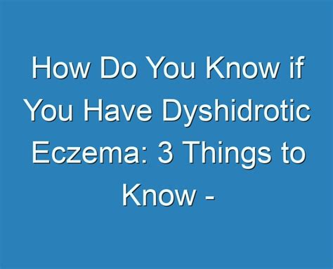 20 Best How Do You Know If You Have Dyshidrotic Eczema 3 Things To