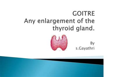 Solution Goitre And Goitre Types Causes And Treatment Studypool