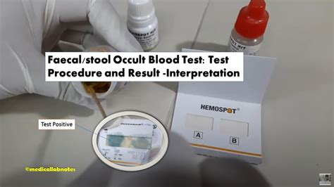 Fecal Occult Blood Test Positive Youtube