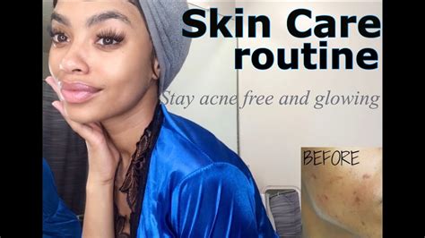 How To Fade Acne Scars And Get Clear Glowing Skin Do This Affordable