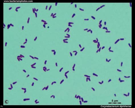 Corynebacterium Chinese Letters Medical Laboratory Labs Life