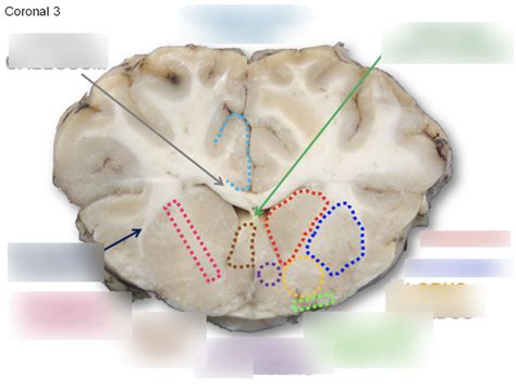 Coronal Sheep Brain Coronal 3 Diagram Quizlet