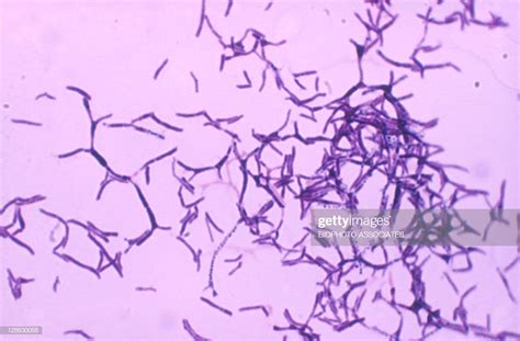 Actinomyces Colony Gram Stain Showing Branching Forms Magnification