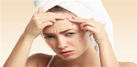 10 Effective And Safe Home Remedies For Acne Or Pimples Max Lab