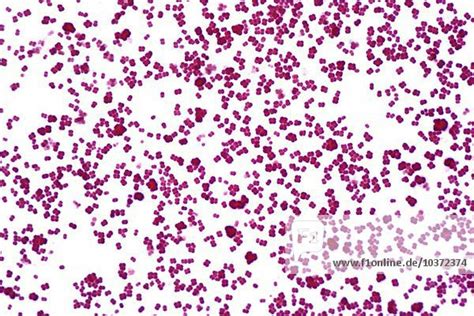 Bacteria Neisseria Sicca A Gram Negative Paired Coccus Gram Stain Lm X