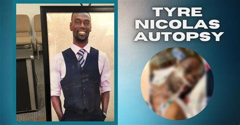 The Autopsy Report Confirms Tyre Nichols Had Excessive Bleeding After Police Encounter