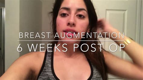 6 Weeks Post Op Breast Augmentation Update Youtube