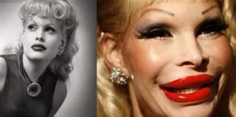 17 Celebrity Before And After Plastic Surgery Disasters Bad Celebrity Plastic Surgery Bad