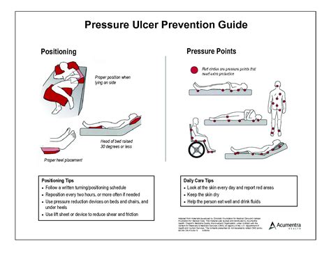 تغذيه صحيح Pressure Ulcer Bed Sores Wound Care