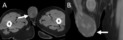 A Axial Contrast Enhanced Computed Tomography Image At The Level Of