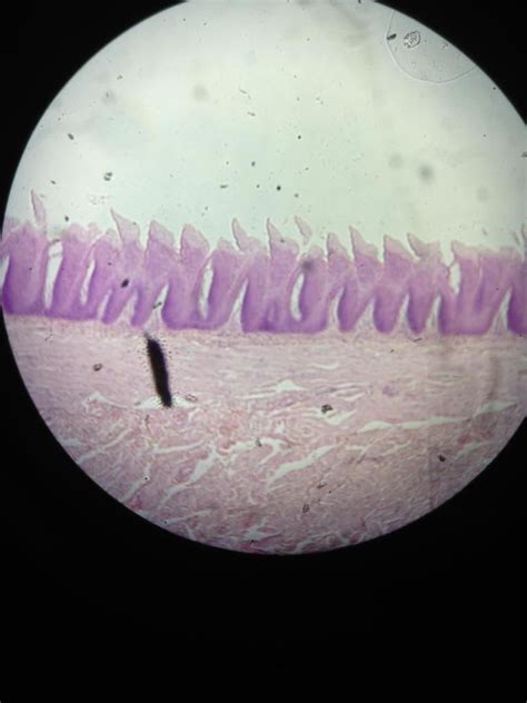 Filiform Papillae Keratinized Stratified Squamous Epithelium