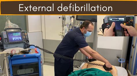 External Defibrillation Dc Shock Youtube