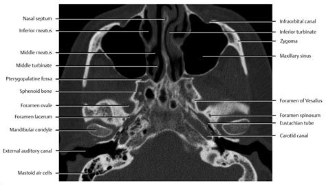 Cross Sectional Computed Tomography And Magnetic Resonance Imaging