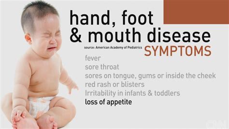 Heads Up Parents Hand Foot And Mouth Disease Is On The Rise
