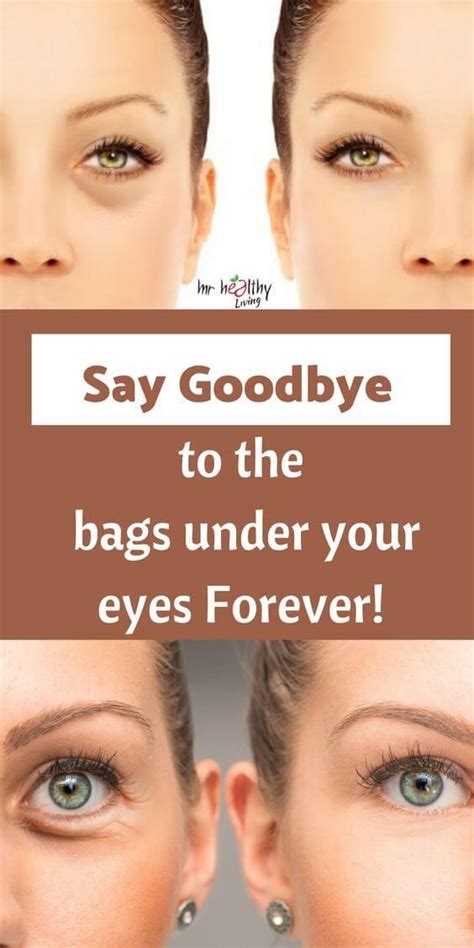Say Goodbye To The Bags Under Your Eyes Forever Mr Healthy Living