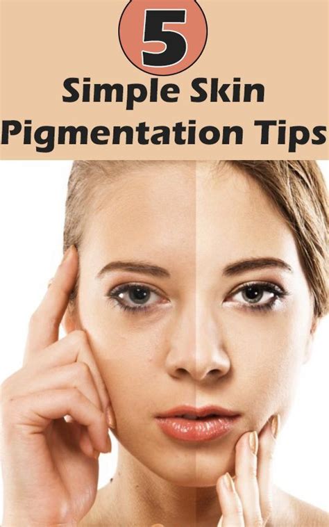 10 Simple Tips On How To Remove Skin Pigmentation Beauty Tips Home