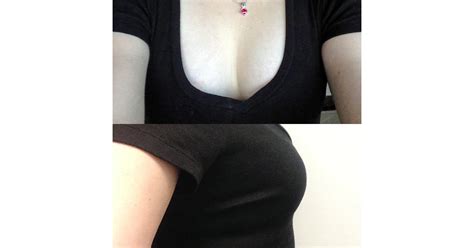 The Results These Images Showcase What My Breasts Looked Like After