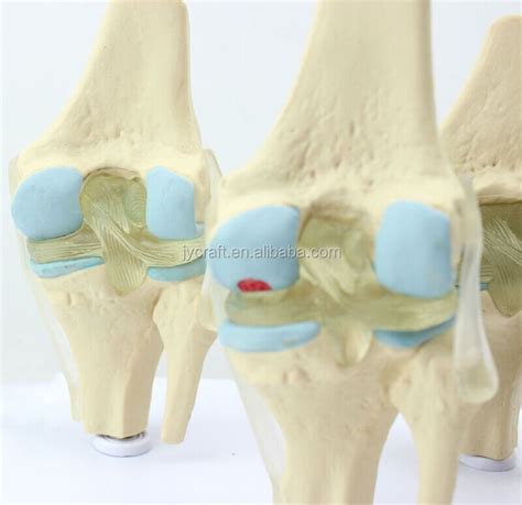 4 Stage Osteoarthritis Knee Skeleton Model Knee Joint Model Buy Knee Joint Model Knee