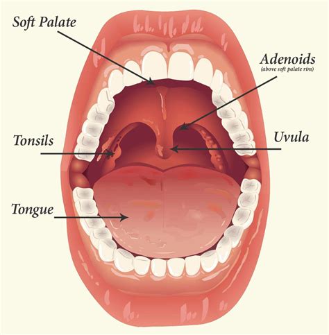 What Causes Large Tonsils In Kids And How To Treat New Kids Center