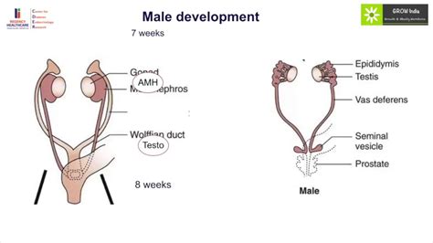 Pathophysiology Of Disorder Of Sexual Development Youtube