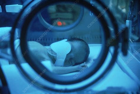 Phototherapy For Jaundice Stock Image C0034477 Science Photo Library