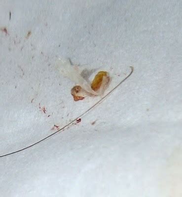 Pinworms On Toilet Paper