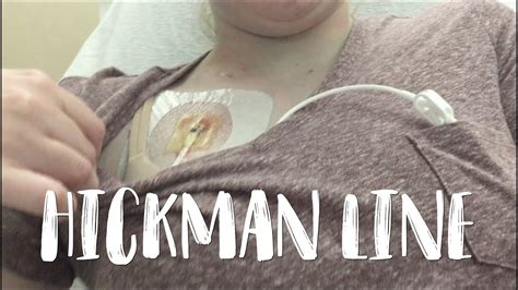 Another Hickman Line Placement Chronic Illness Vlog Youtube