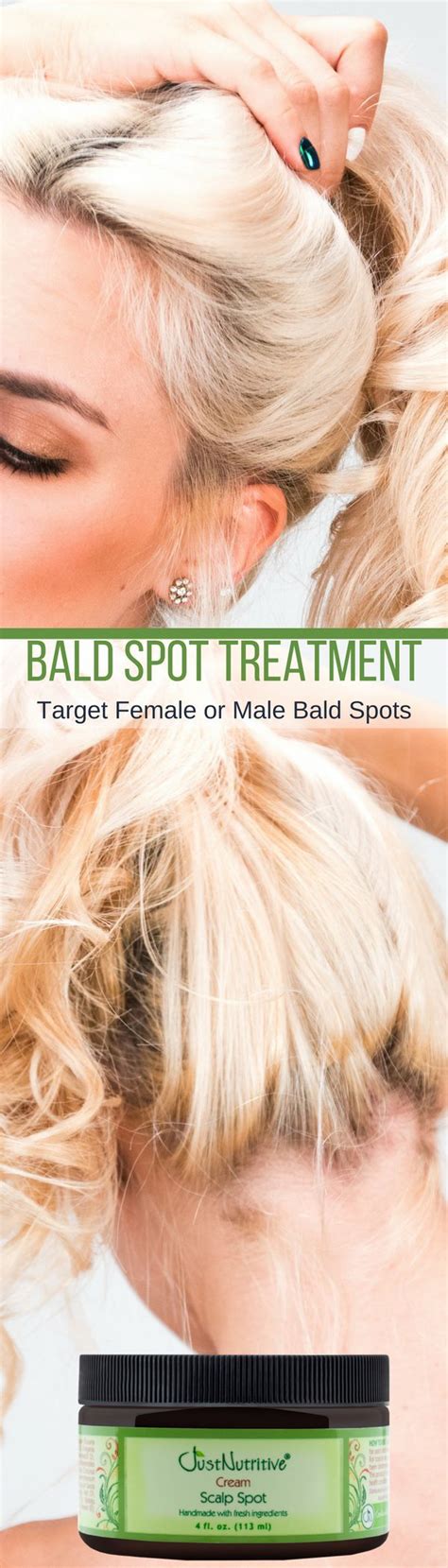 Scalp Spot Cream Bald Spot Treatment Ingrown Hair Treatment Hair