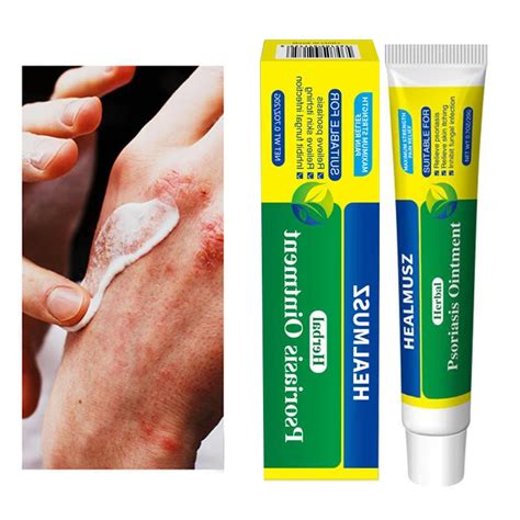 Herbal Antibacterial Cream Psoriasis Cream Dermatitis Eczema Treatment